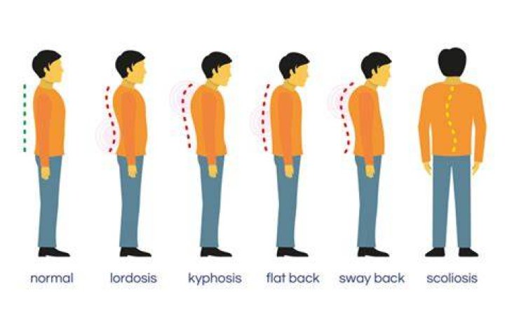 What are postural limitations?