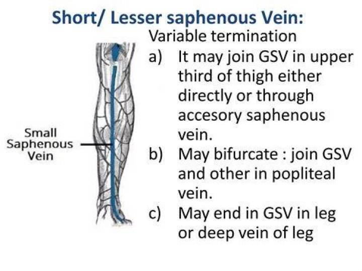 What is the difference between NSV and GSV?